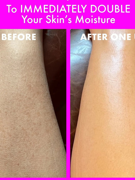 Butterfly Bliss Whipped Body Butter For Stretch Marks And Dry Skin